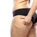 Tipos de celulitis