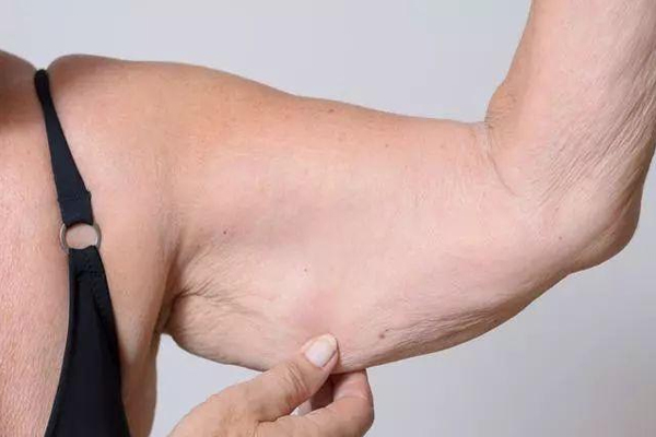 Tipos de celulitis