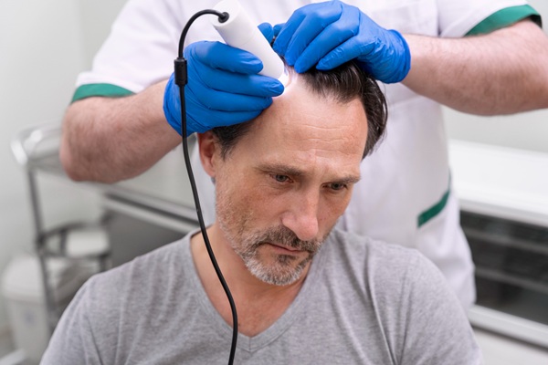 Injerto capilar Madrid - Mejor cirujano capilar España evaluando el cuero cabelludo de un hombre con alopecia para determinar el precio injerto capilar