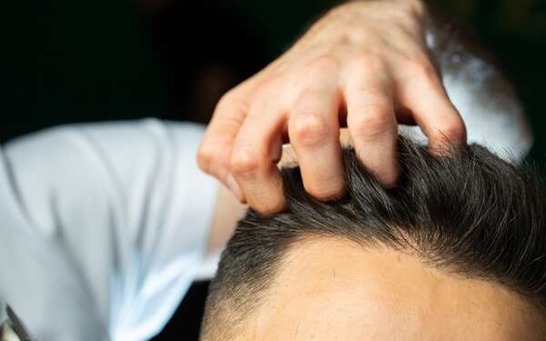Injerto capilar España - Tricólogo evaluando el cabello de un hombre luego de un implante capilar con los mejores doctores injerto capilar España