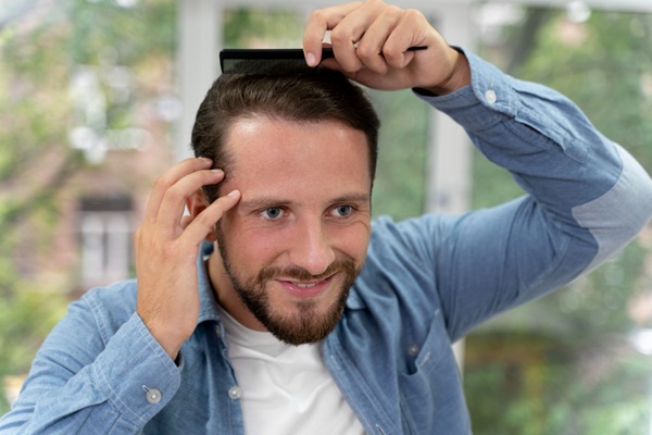 Injerto capilar España - Hombre peinando su cabello abundante y natural luego de un injerto realizado en la mejor clínica implante capilar España